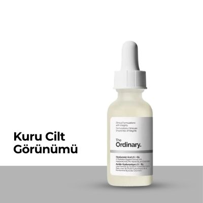 Kuru Cilt
