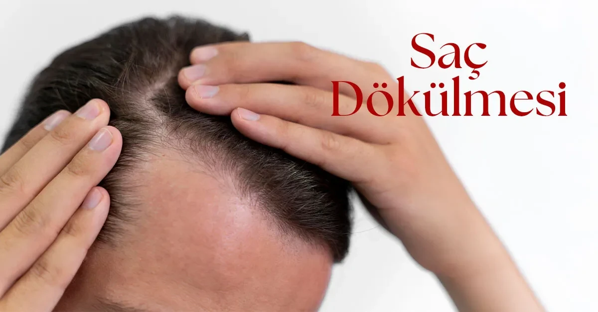 Saç Dökülmesi ve Nedenleri: Hangi Sebepler Saçlarımızı Kaybettiriyor?