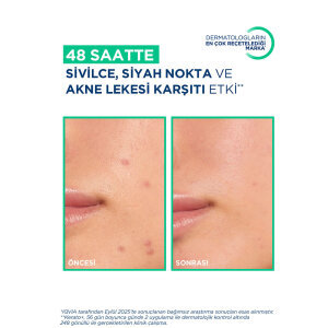 Bioderma Sebium Kerato+ 30 ml - 9