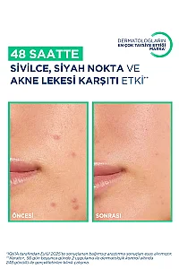 Bioderma Sebium Kerato+ 30 ml - 9
