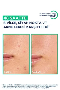 Bioderma Sebium Kerato+ Cover 30 ml - 2