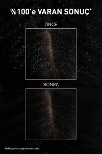 Bioxcin Aqua Thermal Ds Yoğun Kepek Karşıtı Şampuan 200 ml x 2 Adet - 7