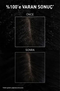 Bioxcin Aqua Thermal Kepek Karşıtı Şampuan 300 ml x 3 Adet - 7