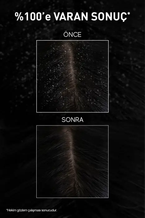 Bioxcin Aqua Thermal Kepek Karşıtı Şampuan 300 ml x 3 Adet - 7