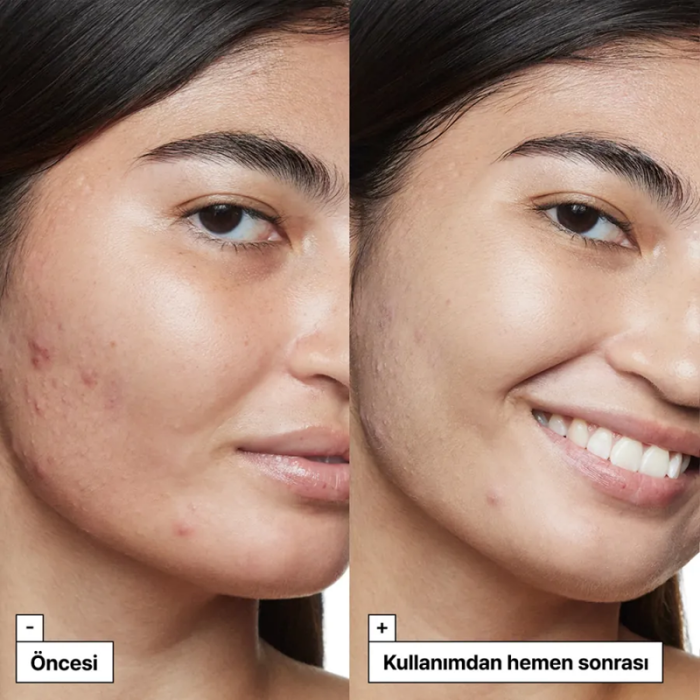 Dr. Jart+ Cicapair Tiger Grass Cildi Yatıştırmaya Yardımcı Solüsyon SPF35 30 ml - 7