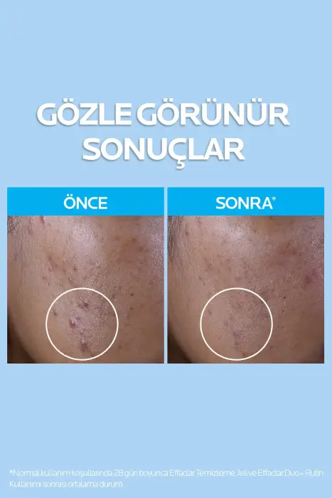 La Roche Posay Yağlı ve Akneye Eğilimli Ciltler için Güneş Bakım Seti - 5