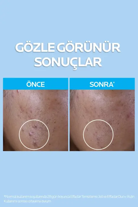 La Roche Posay Yağlı ve Akneye Eğilimli Ciltler için Onarıcı Cilt Bakım Seti - 6
