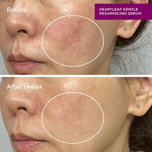 Murad Hydration Sensitive Skin Heartleaf Gentle Resurfacing Serum 30 ml - 3