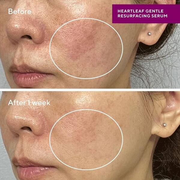 Murad Hydration Sensitive Skin Heartleaf Gentle Resurfacing Serum 30 ml - 3