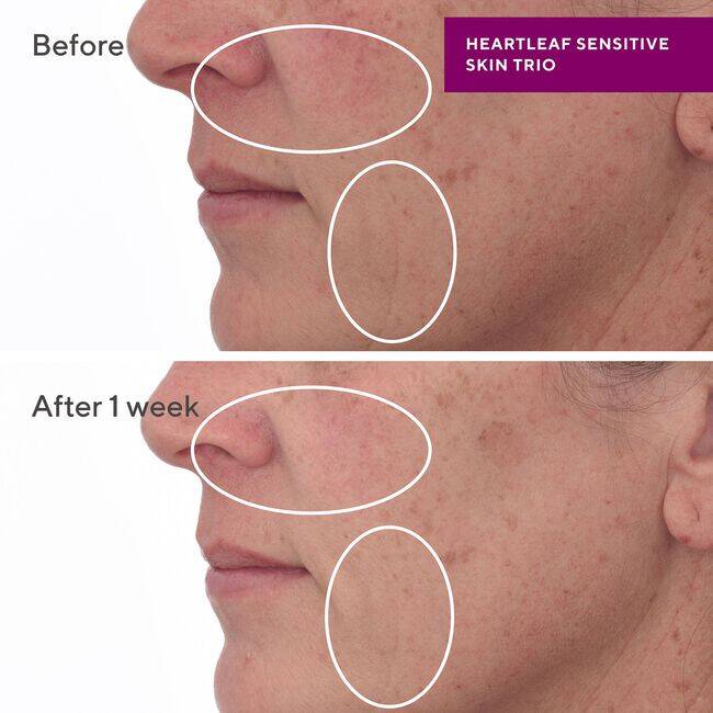 Murad Hydration Sensitive Skin Heartleaf Soothing Cleanser 148 ml - 2