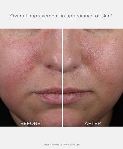 Neostrata Clarify Yağ Kontrolü Sağlayan Nemlendirici 50 ml - 3