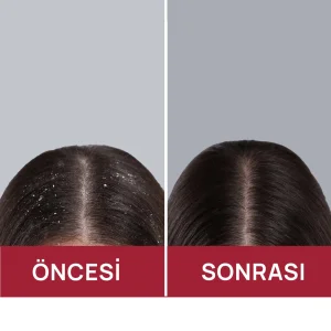 Swissoderm Kepek ve Pullanma Karşıtı Şampuan Tüm Saç Tipleri 300 ml - 7
