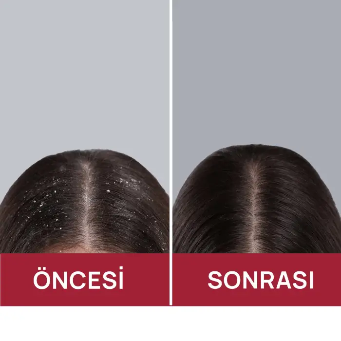 Swissoderm Kepek ve Pullanma Karşıtı Şampuan Tüm Saç Tipleri 300 ml - 7