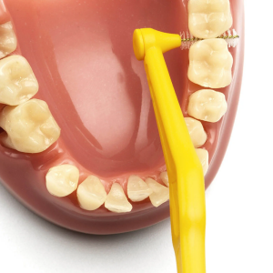 TePe Angle Arayüz Fırçası Sarı 0.7 mm 6'lı Paket - 5