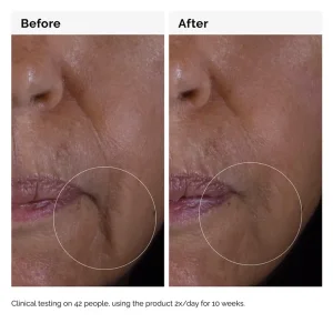 The Ordinary GF 15% Solution Olgun Cilt Destek Serum Solüsyonu 30 ml - 4