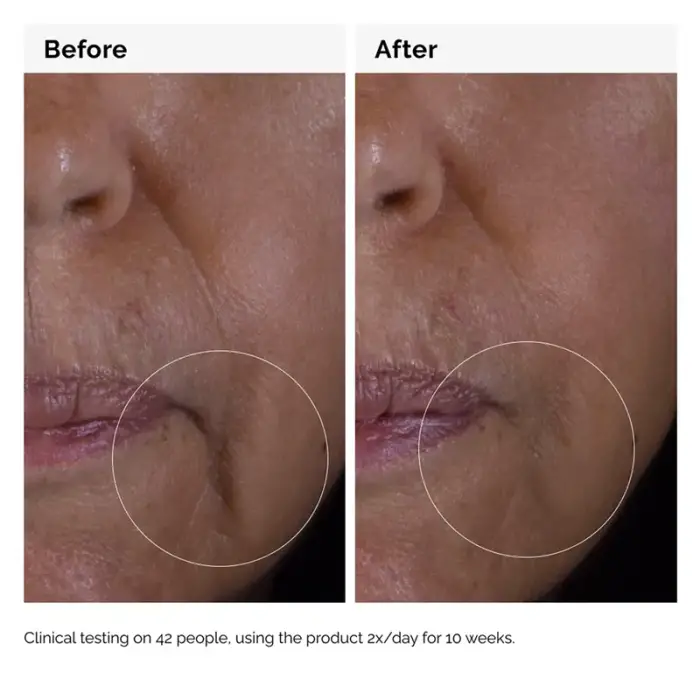 The Ordinary GF 15% Solution Olgun Cilt Destek Serum Solüsyonu 30 ml - 4