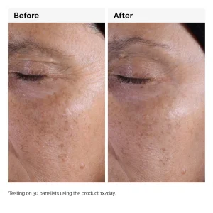 The Ordinary Glycolic Acid 7% Aydınlatmaya ve Pürüzsüzleştirmeye Yardımcı Tonik 240 ml - 5