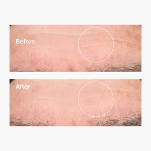 The Ordinary Hyaluronic Acid 2% + B5 Derinlemesine Nemlendirici Serum 60 ml - 4