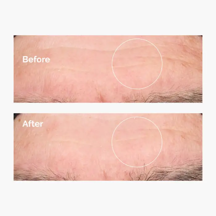 The Ordinary Hyaluronic Acid 2% + B5 Derinlemesine Nemlendirici Serum 60 ml - 4