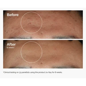 The Ordinary Niacinamide 10% + Zinc 1% Leke ve Gözenek Görünümü Karşıtı Serum 30 ml - 5