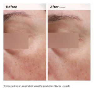 The Ordinary Niacinamide 5% Face & Body Emulsion Yüz ve Vücut Emülsiyonu 100 ml - 6