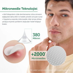 The Purest Solutions Microneedle Teknolojili Akne Patch, Sivilce Karşıtı Yama, Mikroiğneli Akne Bandı 9 Adet - 2