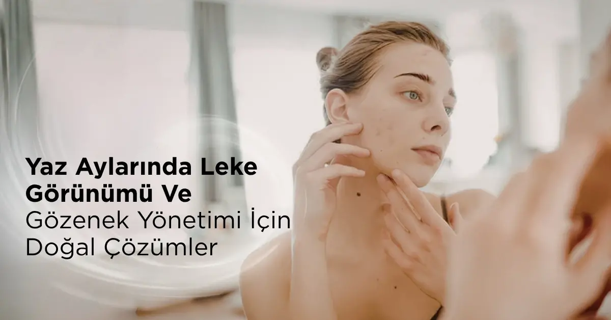 Yaz Aylarında Leke Görünümü Ve Gözenek Yönetimi İçin Doğal Çözümler